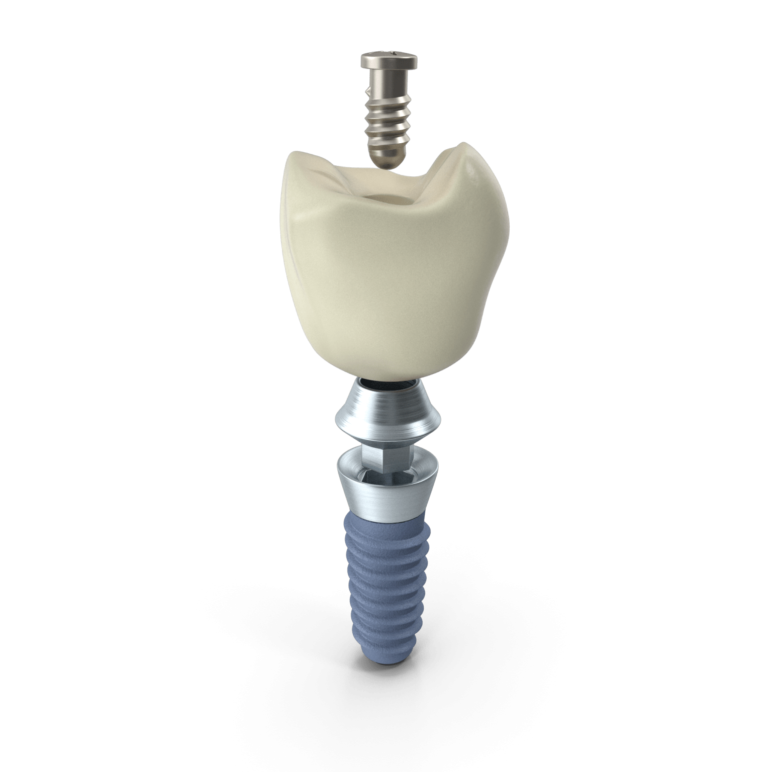 Dental Implants Pinner Road Dental