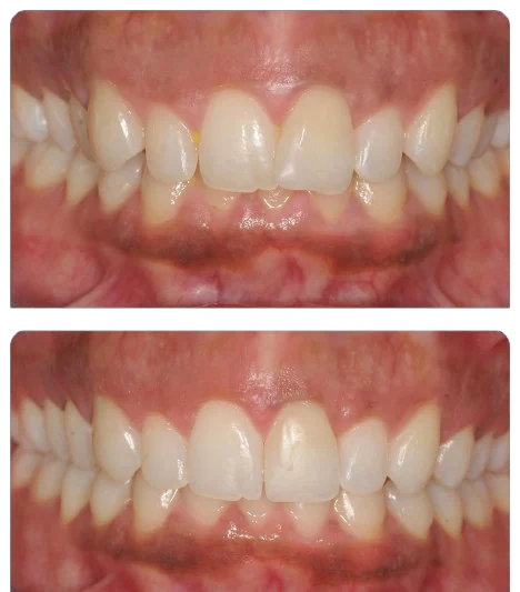 A2BF1485-A1A8-46D6-89D8-6095A5B5E71B-removebg-preview