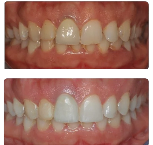 CBB214DC-C018-49DD-BCFE-2FB136F69815-removebg-preview